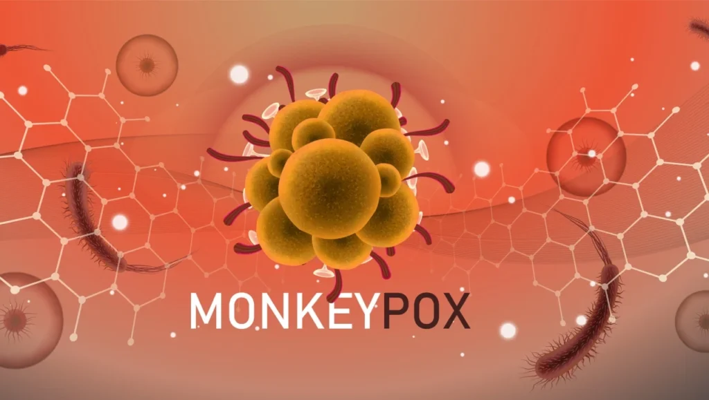 monkeypox