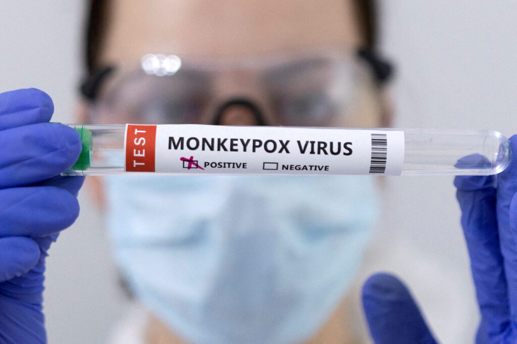 Monkeypox cases in Canada tops 1,400