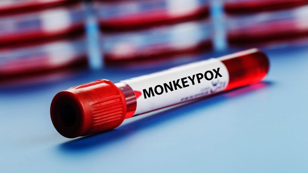 Global Monkeypox cases top 70,000, says WHO