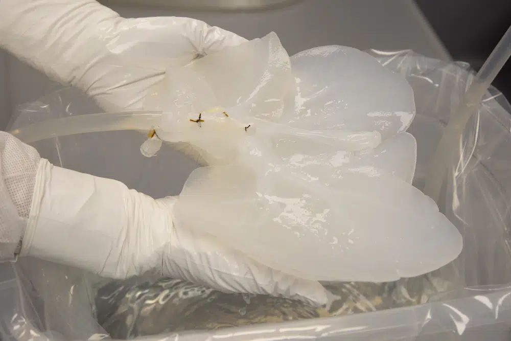 Making pig liver humanlike in quest to ease organ shortage
