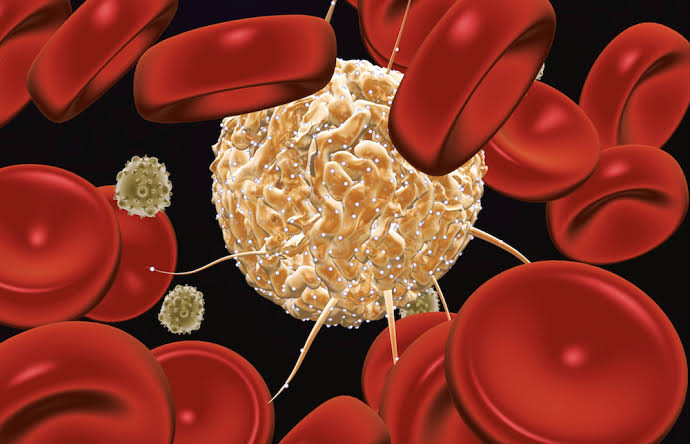 Third person cured of HIV after stem cell transplant