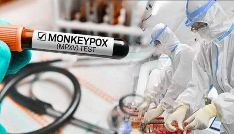 Pakistan reports 1st case of monkeypox virus