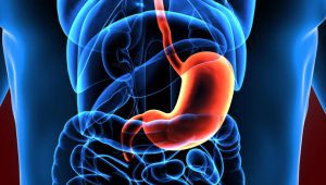 Gastric Bypass Surgery and Long-Term Diabetes Remission